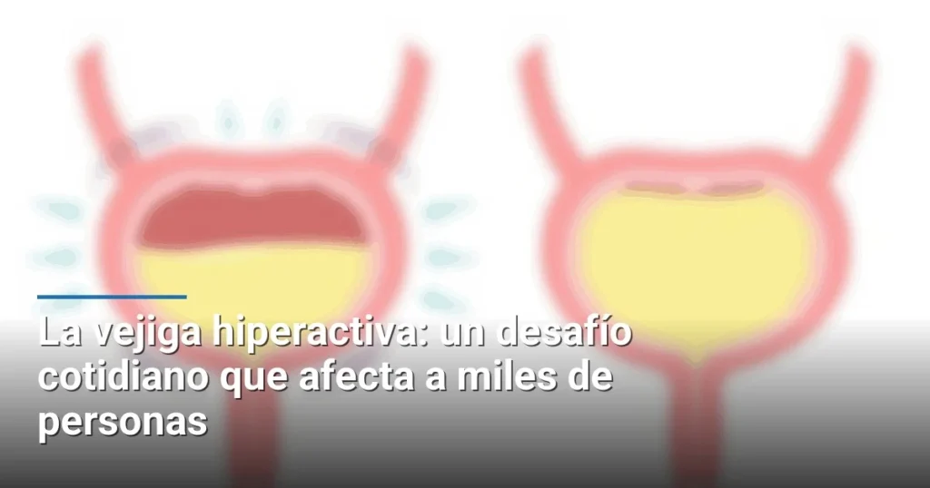 La vejiga hiperactiva: un desafío cotidiano que afecta a miles de personas