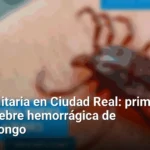 Alerta sanitaria en Ciudad Real: primer caso de fiebre hemorrágica de Crimea-Congo